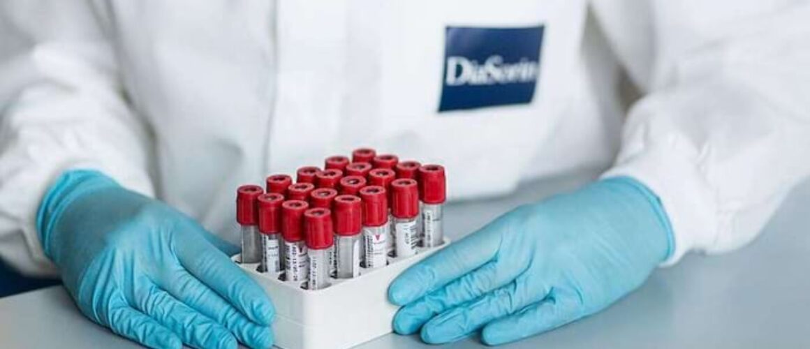 <i>attualita</i>-–-diasorin,-fda-approva-il-test-per-distinguere-tra-influenza-e-covid-19